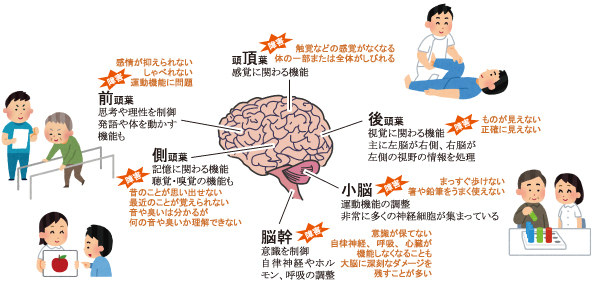 脳の領域ごとの役割 と 脳血管障害により出現する後遺症の例